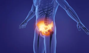 Pelvic Dysfunction and Groin Pain